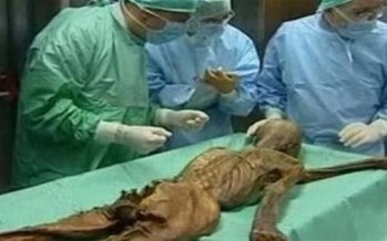 مومياء تكشف أسراراً عن جرثومة المعدة
