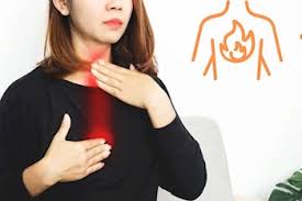 طرق طبيعية لعلاج حرقة المعدة والحموضة في المنزل بسرعة