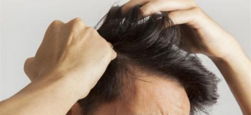 التوتر النفسي من أسباب ظهور قشرة الرأس التوتر النفسي من أسباب ظهور قشرة الرأس