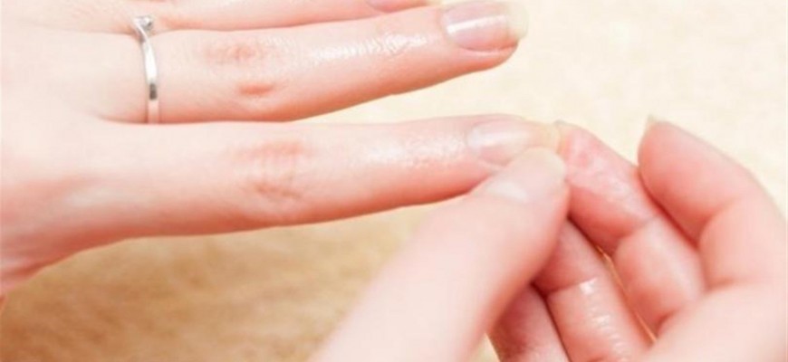 تقصّف الأظافر مشكلة جماليّة... هذه أسبابها وحلولها تقصّف الأظافر مشكلة جماليّة... هذه أسبابها وحلولها