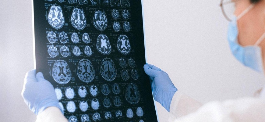 «مرض دماغي يسبب الهلوسة والوفاة».. يوقع أطباء كندا في حيرة شديدة