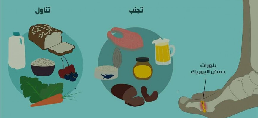 أطعمة تزيد حمض اليوريك في الجسم وتسبب النقرس أطعمة تزيد حمض اليوريك في الجسم وتسبب النقرس