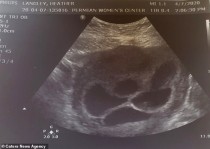0The_couple_had_a_scan_at_19_weeks_to_find_out_the_gender_of_thei-a-126_1611663707116.jpg