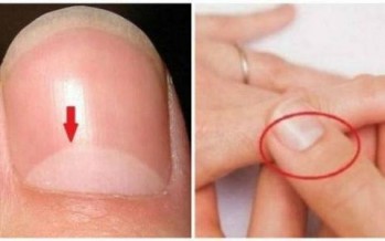 هذه الدائرة على ظفركم تخبر أشياء كثيرة عن صحتكم !