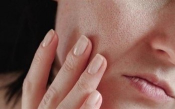 مشكلة جماليّة شائعة.. هكذا تتخلّصين منها