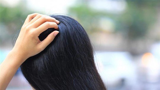 أسباب شائعة لحكّة فروة الرأس أسباب شائعة لحكّة فروة الرأس