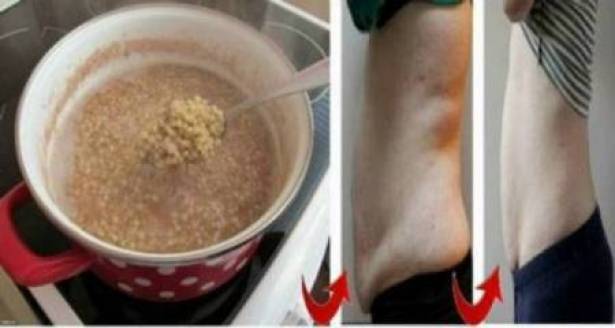 إخسروا 14 كلغ في أسبوعين بواسطة هذه النبتة الطبيعية