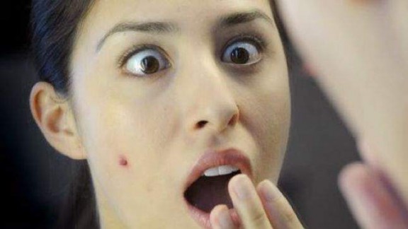 حيلة مضمونة لإزالة البثور في يوم واحد…اكتشفيها فورا! حيلة مضمونة لإزالة البثور في يوم واحد…اكتشفيها فورا!
