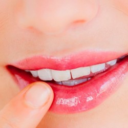 خلطات طبيعية لعلاج تشقق الشفاه خلطات طبيعية لعلاج تشقق الشفاه