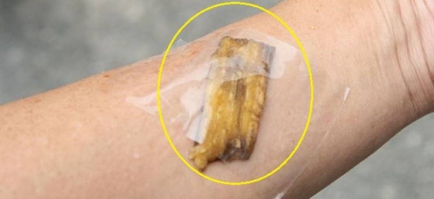 ماذا يحدث لبشرتك عند وضعك قشرة موز بهذه الطريقة؟! ماذا يحدث لبشرتك عند وضعك قشرة موز بهذه الطريقة؟!