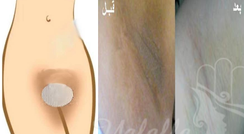 جمال بشرتك جمال بشرتك