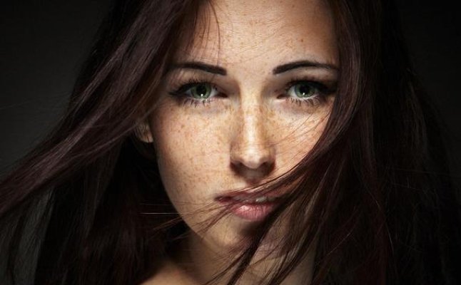 تخلصي من النمش نهائياً بهذه الطرق الطبيعية تخلصي من النمش نهائياً بهذه الطرق الطبيعية