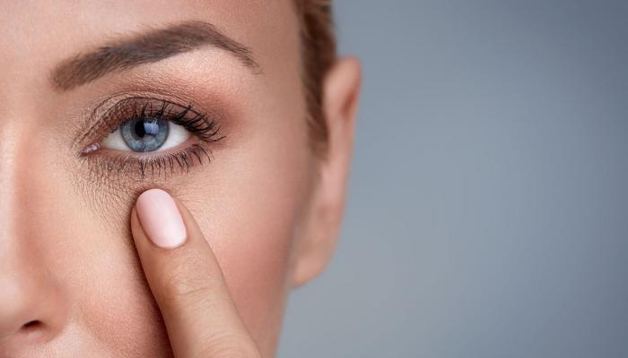 علاج الهالات السوداء تحت العين.. اتبعي هذه الخطوات